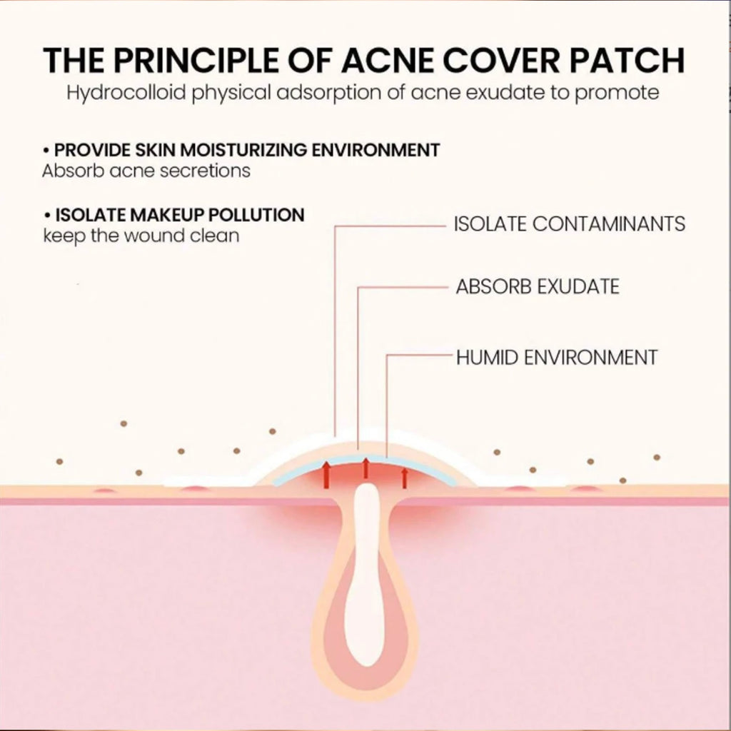 Pimple Patches