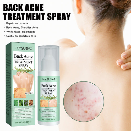 AcneAway Back Spray