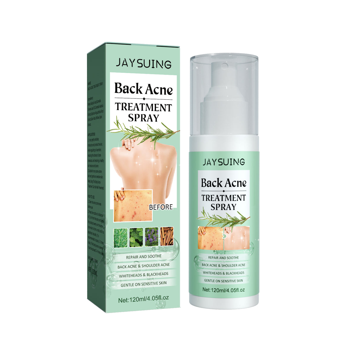 AcneAway Back Spray