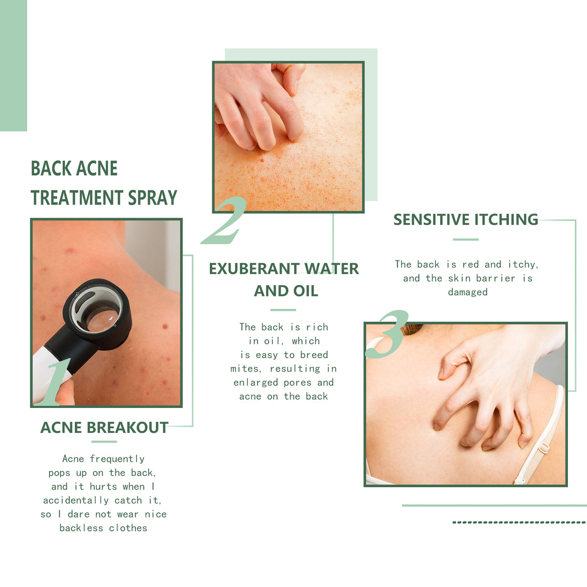 AcneAway Back Spray
